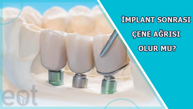 implant-sonrasi-cene-agrisi