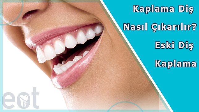 Kaplama Diş Nasıl Çıkarılır? Eski Diş Kaplama