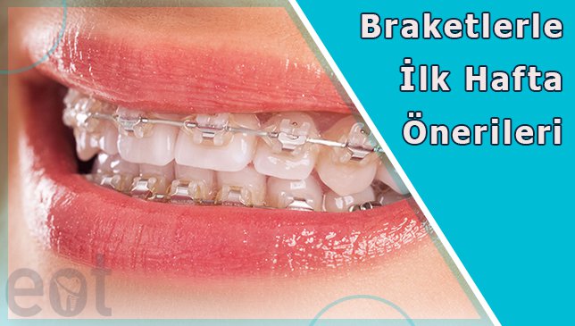 BRAKETLERLE İLK HAFTA ÖNERİLERİ