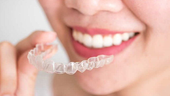 Telsiz Diş Düzeltme Ortodonti Tedavisi Nedir?