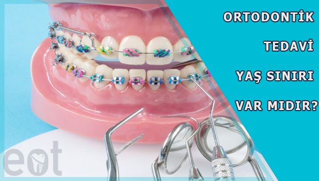 Ortodontik-Tedavi-yas
