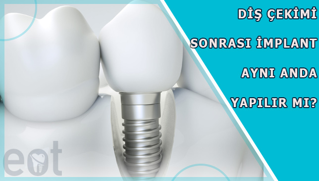 dis-cekimi-sonrasi