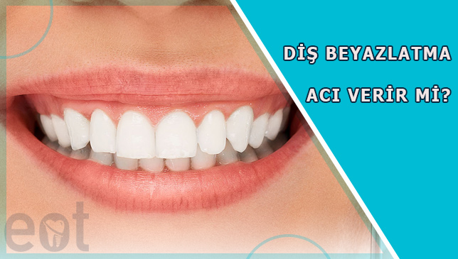 dis-beyazlatma-aci