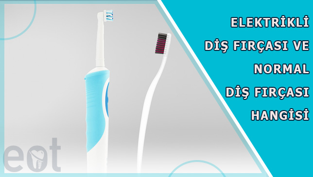 elektirikli-dis-fircasi