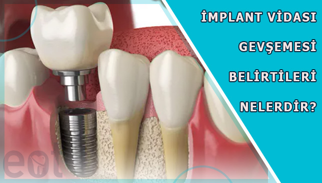 implant-Vidasi-Gevsemesi-Belirtileri