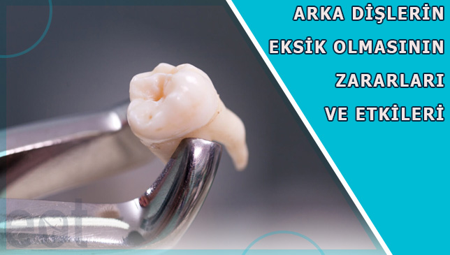 Arka-Dislerin-Eksik
