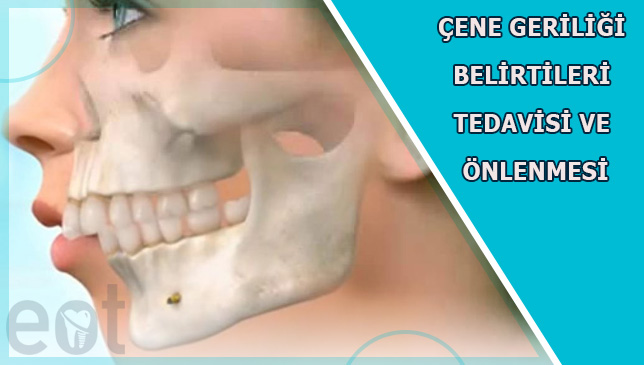 cene-geriligi-belirtileri-tedavisi