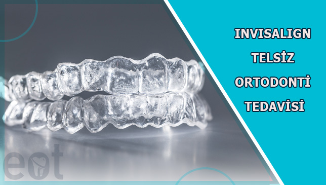 Invisalign-Telsiz-Ortodonti