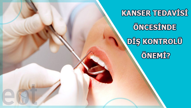 Kanser Tedavisi Öncesinde Diş