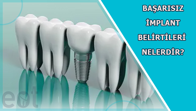 Başarısız İmplant Belirtileri